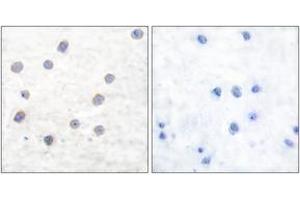 Immunohistochemistry analysis of paraffin-embedded human brain, using Tyrosine Hydroxylase (Phospho-Ser40) Antibody. (Tyrosine Hydroxylase Antikörper  (pSer71))