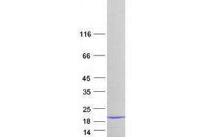 Western Blotting (WB) image for LSM3 Homolog, U6 Small Nuclear RNA Associated (LSM3) protein (Myc-DYKDDDDK Tag) (ABIN2724982)