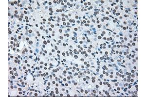 Image no. 1 for anti-B-Raf proto-oncogene, serine/threonine kinase (BRAF) antibody (ABIN1496961) (BRAF Antikörper)