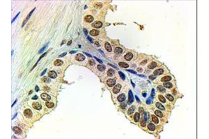 ABIN185266 (2µg/ml) staining of paraffin embedded Human Prostate. (Androgen Receptor Antikörper  (N-Term))