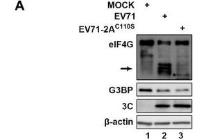 Protease activity of 2A is required for tSG blockage and aSG induction during EV71 infection. (beta Actin Antikörper)