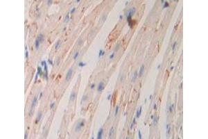 Used in DAB staining on fromalin fixed paraffin- embedded Kidney tissue (ADCY9 Antikörper  (AA 852-1065))