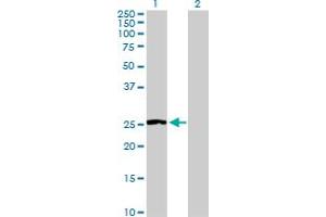Western Blot analysis of NNMT expression in transfected 293T cell line by NNMT MaxPab polyclonal antibody. (NNMT Antikörper  (AA 1-264))