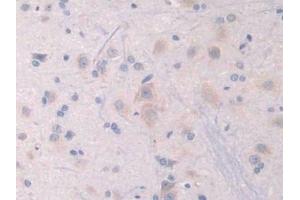 IHC-P analysis of Rat Cerebrum Tissue, with DAB staining.