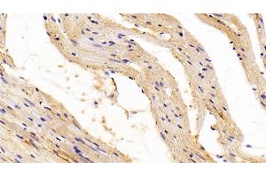 Detection of TGFb1 in Rat Cardiac Muscle Tissue using Polyclonal Antibody to Transforming Growth Factor Beta 1 (TGFb1) (TGFB1 Antikörper  (AA 279-390))