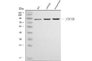 Western blot analysis of TTC7B using anti-TTC7B antibody (ABIN7601050). (TTC7B Antikörper  (AA 275-730))