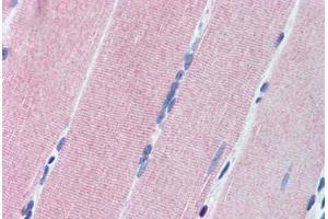 Immunohistochemistry (Paraffin-embedded Sections) (IHC (p)) image for anti-Protein Kinase, CGMP-Dependent, Type I (PRKG1) (AA 657-671) antibody (ABIN307178)