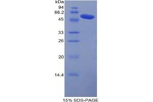 SDS-PAGE analysis of Mouse Carboxypeptidase N1 Protein. (CPN1 Protein)