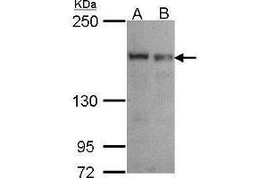 WB Image Sample (30 ug of whole cell lysate) A: A549 B: Hela 5% SDS PAGE antibody diluted at 1:1000