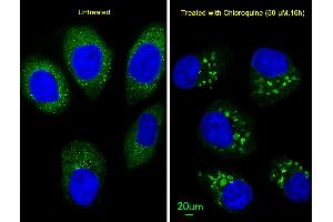 Immunofluorescent analysis of  cells, using LC3 Antibody (G8B) (N-term) 1802a. (MAP1LC3A Antikörper  (N-Term))