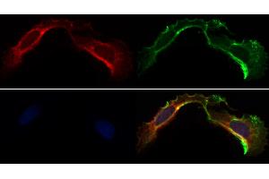 ABIN6263304 and ABIN6266596 staining Hela by IF/ICC.