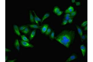 Immunofluorescent analysis of Hela cells using ABIN7146715 at dilution of 1:100 and Alexa Fluor 488-congugated AffiniPure Goat Anti-Rabbit IgG(H+L) (CA2 Antikörper  (AA 2-260))