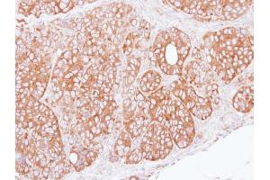 IHC-P Image Immunohistochemical analysis of paraffin-embedded SW480 xenograft, using ret finger protein, antibody at 1:100 dilution. (TRIM27 Antikörper)