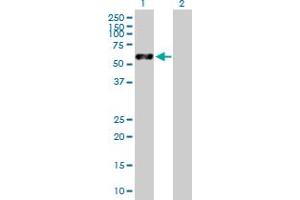 Western Blot analysis of VIM expression in transfected 293T cell line by VIM MaxPab polyclonal antibody.