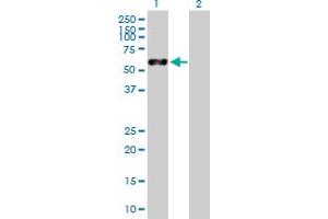 Western Blot analysis of VIM expression in transfected 293T cell line by VIM MaxPab polyclonal antibody. (Vimentin Antikörper  (AA 1-466))
