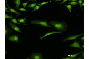 Immunofluorescence of purified MaxPab antibody to BOLL on HeLa cell. (BOLL Antikörper  (AA 1-295))
