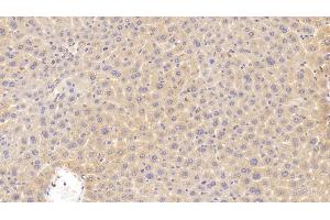 Immunohistochemistry (IHC) image for anti-Cyclin-Dependent Kinase Inhibitor 2B (p15, Inhibits CDK4) (CDKN2B) (AA 1-130) antibody (ABIN7445228)