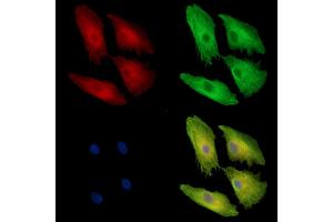 ABIN7097092 and ABIN7101159 staining  cells by IF/ICC. (Desmocollin 1 Antikörper)