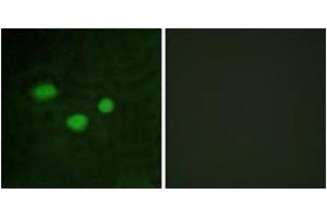 Immunofluorescence analysis of HeLa cells, using DNMT3B Antibody. (DNMT3B Antikörper  (AA 1-50))