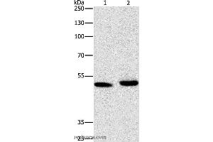 Western blot analysis of 231 cell and human liver cancer tissue, using ATG4A Polyclonal Antibody at dilution of 1:300 (ATG4A Antikörper)