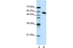 WB Suggested Anti-NONO Antibody Titration:  1. (NONO Antikörper  (N-Term))