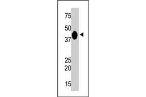 The CKMT2 polyclonal antibody  is used in Western blot to detect CKMT2 in mouse muscle tissue lysate . (CKMT2 Antikörper  (C-Term))