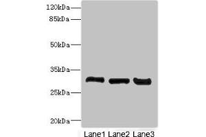 Western blot All lanes: KHKantibody at 3. (Ketohexokinase Antikörper  (AA 1-298))