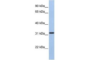 SLC25A28 antibody used at 1 ug/ml to detect target protein. (SLC25A28 Antikörper  (C-Term))