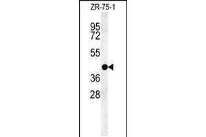 Western blot analysis in ZR-75-1 cell line lysates (35ug/lane). (PSG9 Antikörper  (AA 108-137))
