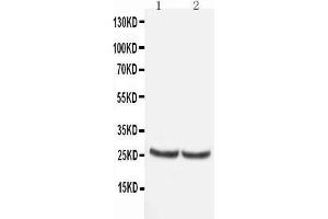 Anti-TIMP4 antibody, Western blotting All lanes: Anti TIMP4  at 0.