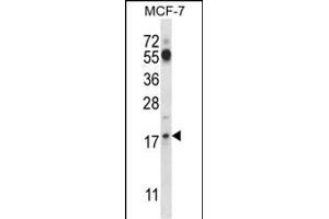SSSCA1 Antibody (N-term ) (ABIN657577 and ABIN2846581) western blot analysis in MCF-7 cell line lysates (35 μg/lane). (SSSCA1 Antikörper  (N-Term))