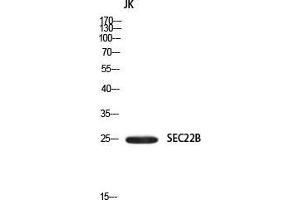 Western Blot (WB) analysis of JK using SEC22B antibody. (SEC22B Antikörper)
