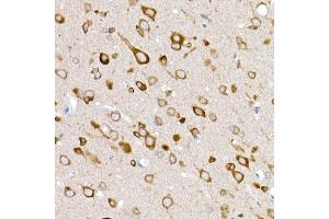 Immunohistochemistry of paraffin-embedded rat brain using GLUT3/SLC2 Rabbit pAb (ABIN6134111, ABIN6147961, ABIN6147962 and ABIN6224173) at dilution of 1:50 (40x lens). (SLC2A3 Antikörper  (AA 150-250))