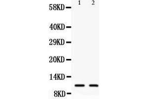 Anti-Eotaxin3 antibody, Western blotting All lanes: Anti Eotaxin3  at 0. (CCL26 Antikörper  (C-Term))