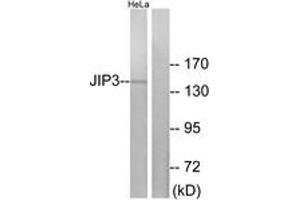 Western Blotting (WB) image for anti-Mitogen-Activated Protein Kinase 8 Interacting Protein 3 (MAPK8IP3) (AA 621-670) antibody (ABIN2889810) (JIP3 Antikörper  (AA 621-670))