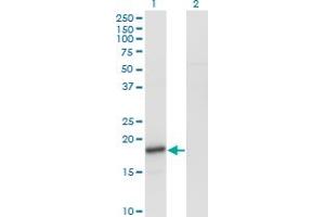 Western Blot analysis of SNCA expression in transfected 293T cell line by SNCA monoclonal antibody (M01), clone 2E4. (SNCA Antikörper  (AA 31-140))