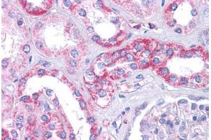 Human Kidney: Formalin-Fixed, Paraffin-Embedded (FFPE) (SIPA1L1 Antikörper  (N-Term))