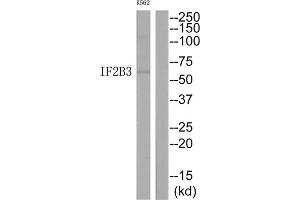 Western Blotting (WB) image for anti-Insulin-Like Growth Factor 2 mRNA Binding Protein 3 (IGF2BP3) (N-Term) antibody (ABIN1848922) (IGF2BP3 Antikörper  (N-Term))