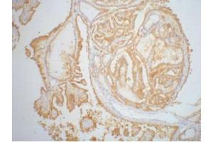 Immunohistochemistry (IHC) staining of Human thyroid tissue paraffin-embedded, diluted at 1:200. (Galectin 3 Antikörper)