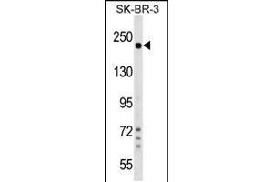 Western blot analysis in SK-BR-3 cell line lysates (35ug/lane). (SHROOM2 Antikörper  (AA 599-625))