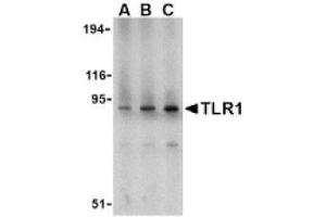 Image no. 1 for anti-Toll-Like Receptor 1 (TLR1) (N-Term) antibody (ABIN951276) (TLR1 Antikörper  (N-Term))