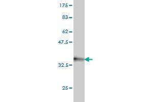 Western Blot detection against Immunogen (31. (HOXA7 Antikörper  (AA 58-112))