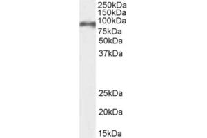 Western Blot using anti-CD155 antibody 3F1. (Rekombinanter Poliovirus Receptor Antikörper)