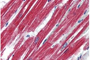 Human Heart (formalin-fixed, paraffin-embedded) stained with LEPR antibody ABIN364407 at 4 ug/ml followed by biotinylated anti-goat IgG secondary antibody ABIN481715, alkaline phosphatase-streptavidin and chromogen. (Leptin Receptor Antikörper  (AA 829-841))