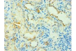 Immunohistochemistry of paraffin-embedded human kidney tissue using ABIN7144142 at dilution of 1:100 (SLC4A2 Antikörper  (AA 95-245))