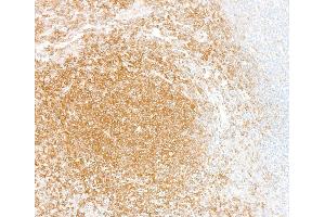 Immunohistochemistry (IHC) image for anti-Nuclear Factor-kB p65 (NFkBP65) (C-Term) antibody (ABIN7795799)