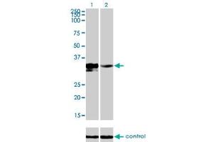 Western blot analysis of DLX3 over-expressed 293 cell line, cotransfected with DLX3 Validated Chimera RNAi (Lane 2) or non-transfected control (Lane 1). (DLX3 Antikörper  (AA 1-287))