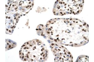 SETD2 antibody was used for immunohistochemistry at a concentration of 4-8 ug/ml to stain Trophoblast cells (arrows) in Human Placenta. (SETD2 Antikörper  (N-Term))