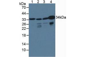 Western blot analysis of (1) Porcine Brain Tissue, (2) Human HepG2 Cells, (3) Human HeLa cells and (4) Human K562 Cells. (CrkL Antikörper  (AA 1-303))