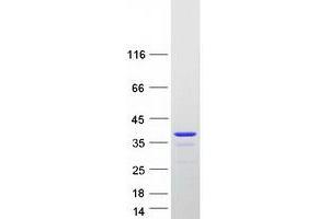 Western Blotting (WB) image for AlkB, Alkylation Repair Homolog 2 (ALKBH2) (Transcript Variant 1) protein (Myc-DYKDDDDK Tag) (ABIN2714577)